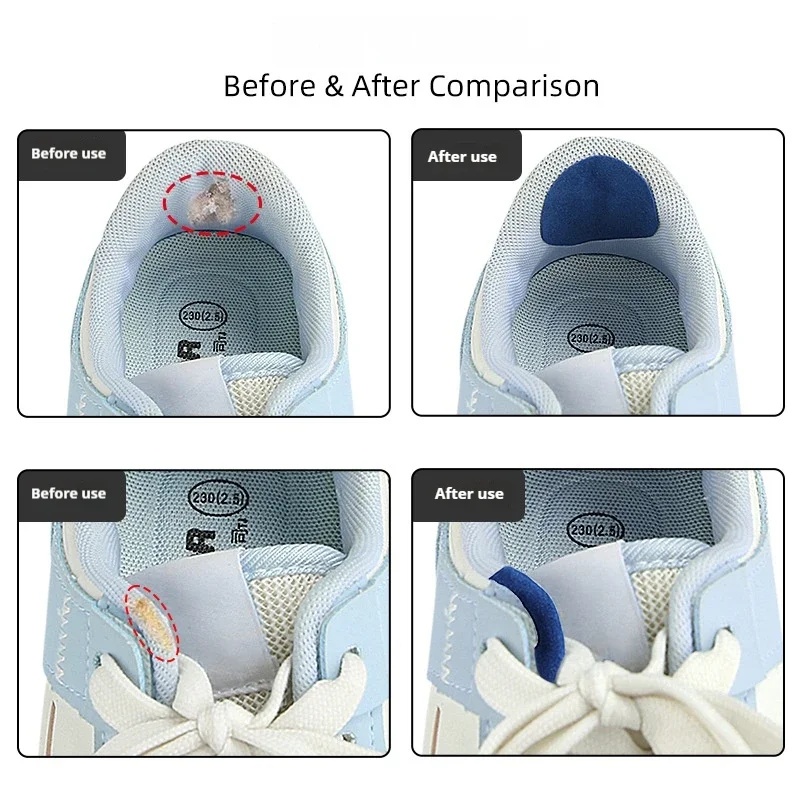 6 Pezzi di Patch per Scarpe Sp - Sports Equipment Repair recensione e prezzo
